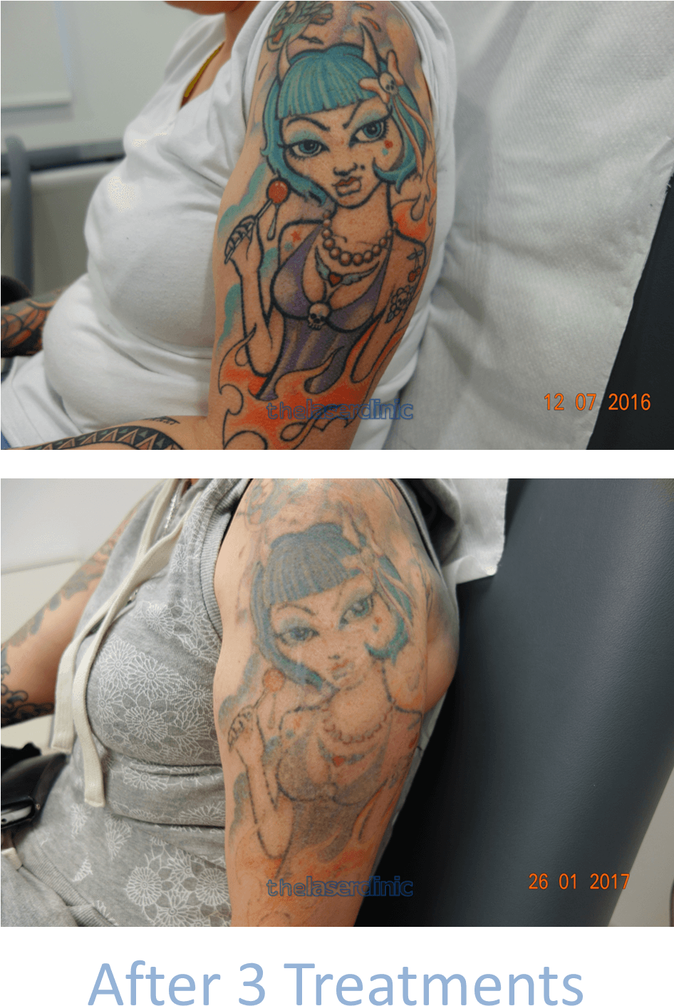 Fading This Brightly Coloured Tattoo Required Only - Color Tattoo Photos Download, HD Png Download - Transparent PNG Free Download | PNGio