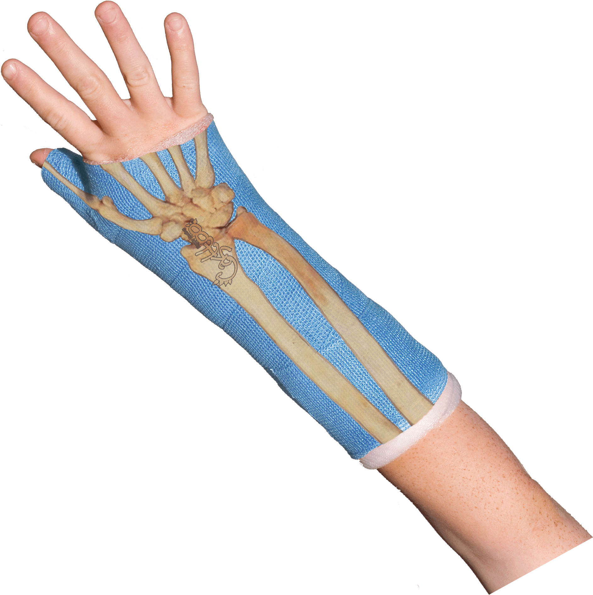 Bones Wrist Bones Casttoo Orthopedic Cast Tattoos Gif - Orthopedic Cast, HD Png Download - Transparent PNG Free Download | PNGio
