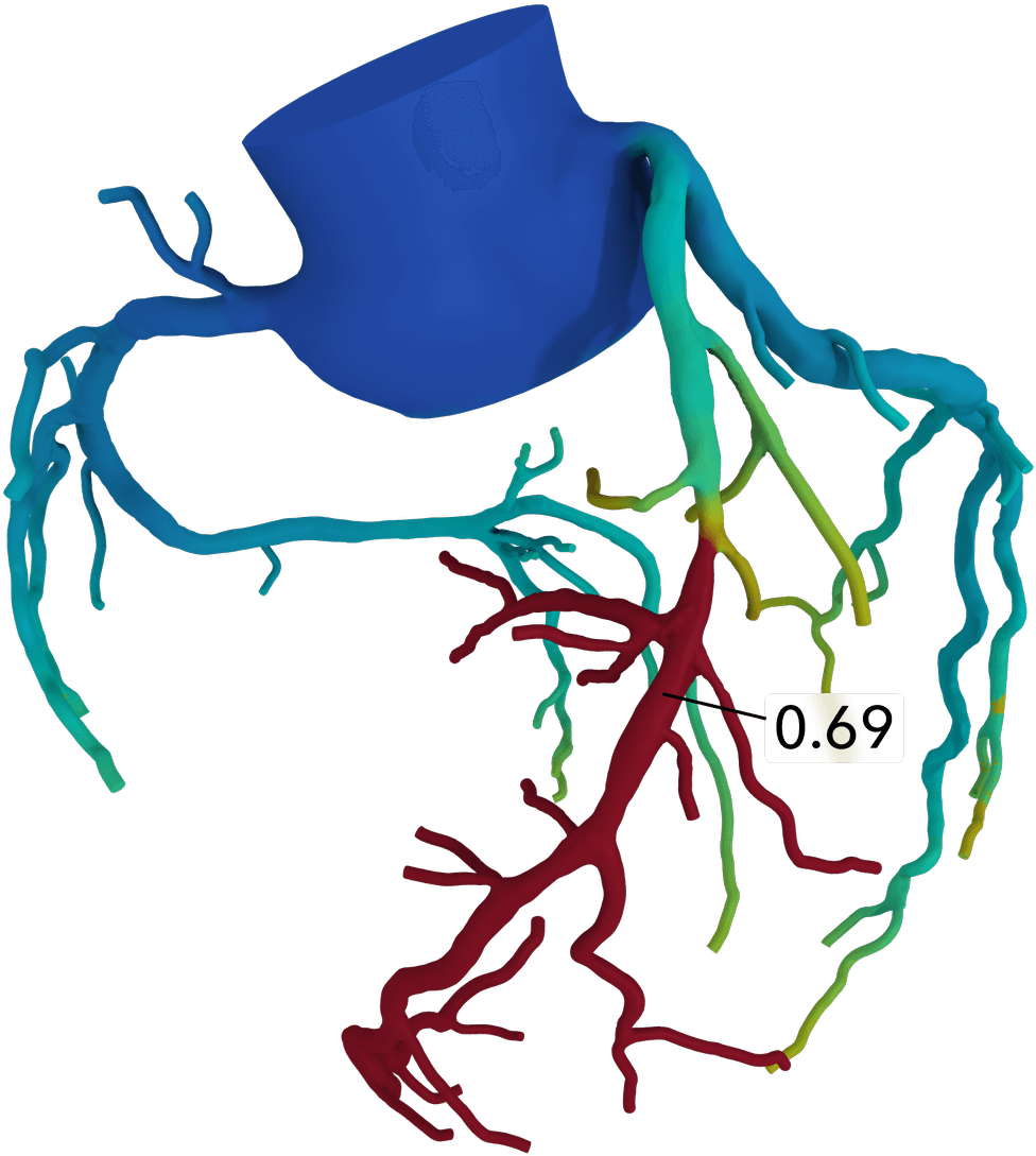 “people Ask How Can We Afford To Have These Kinds Of - Heartflow - Transparent PNG Free Download | PNGio