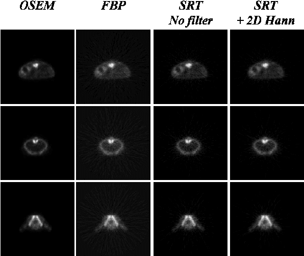 Three Different Slices Of An Fdg Mouse Scan Acquired - Moon - Transparent PNG Free Download | PNGio