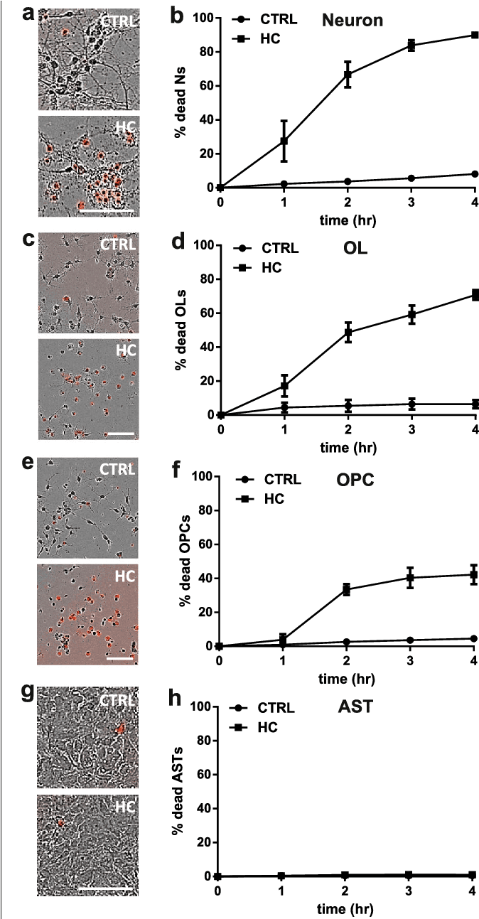 Human Complement Is Toxic To Mouse Neurons And Oligodendrocytes - Transparent PNG Free Download | PNGio