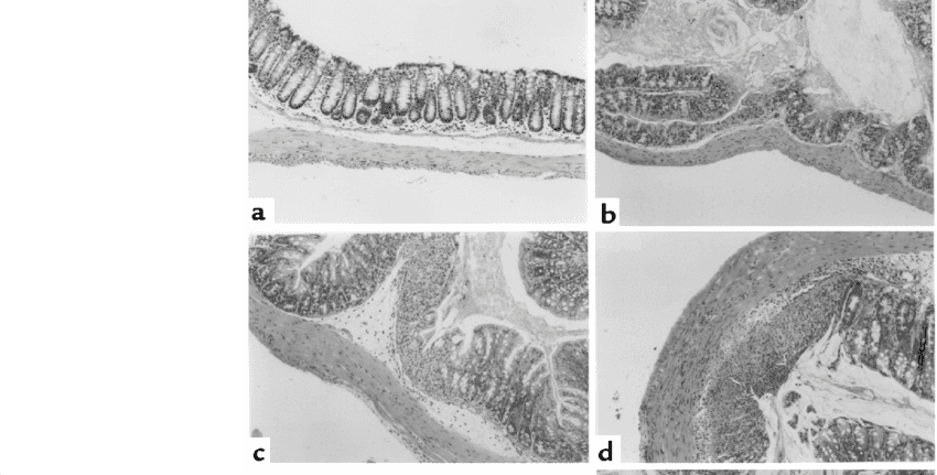 Photomicrographs Of The Proximal Colon Of Mice Treated - Monochrome - Transparent PNG Free Download | PNGio