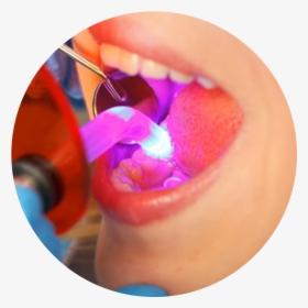 Transparent Dentist Tools Png - Polymerization Dental, Png Download - Technology Transparent PNG Free Download